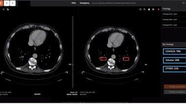 سامانه هوشمند تشخیص کرونا دانشگاه شریف